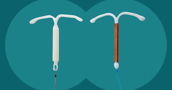 Falsas creencias sobre el DIU ventajas desventajas y consideraciones importantes. MyContraception Spain